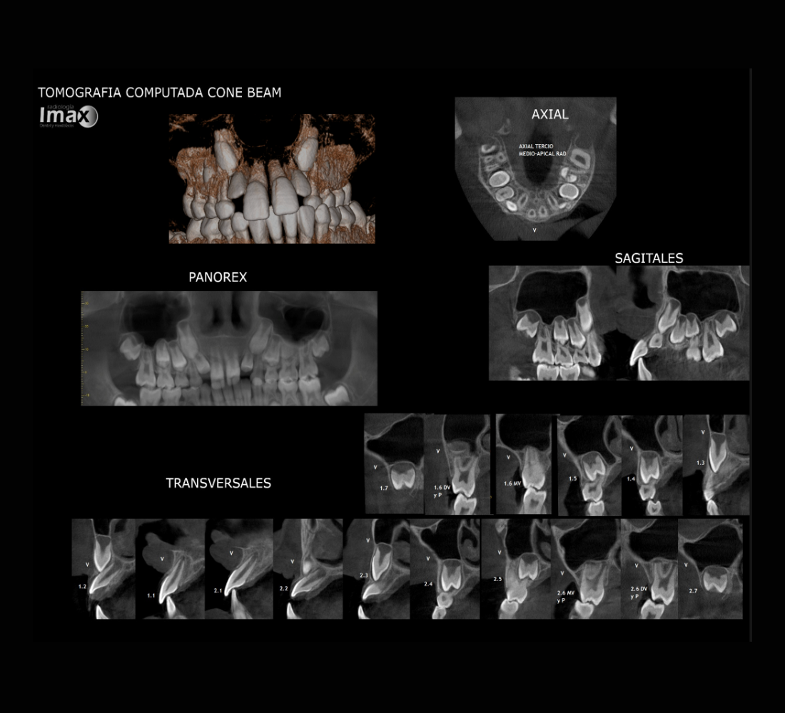 Tomografía computarizada Cone Beam con reconstrucción 3D