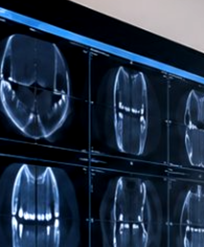 Radiografía dental en el viewer diagnóstico
