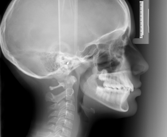 Telerradiografía cervical · Dinámica